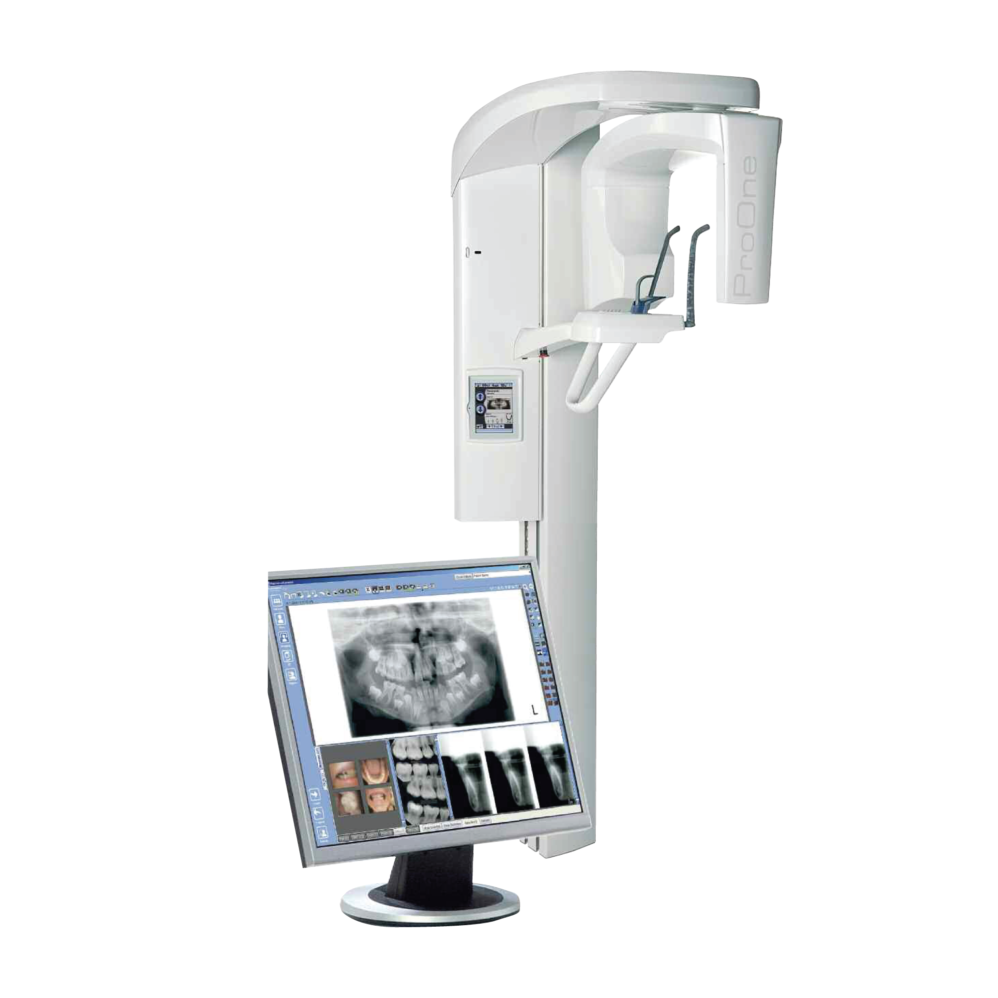 OPG (Orthopantomogram) Machine – Panoramic Dental Imaging from Finland