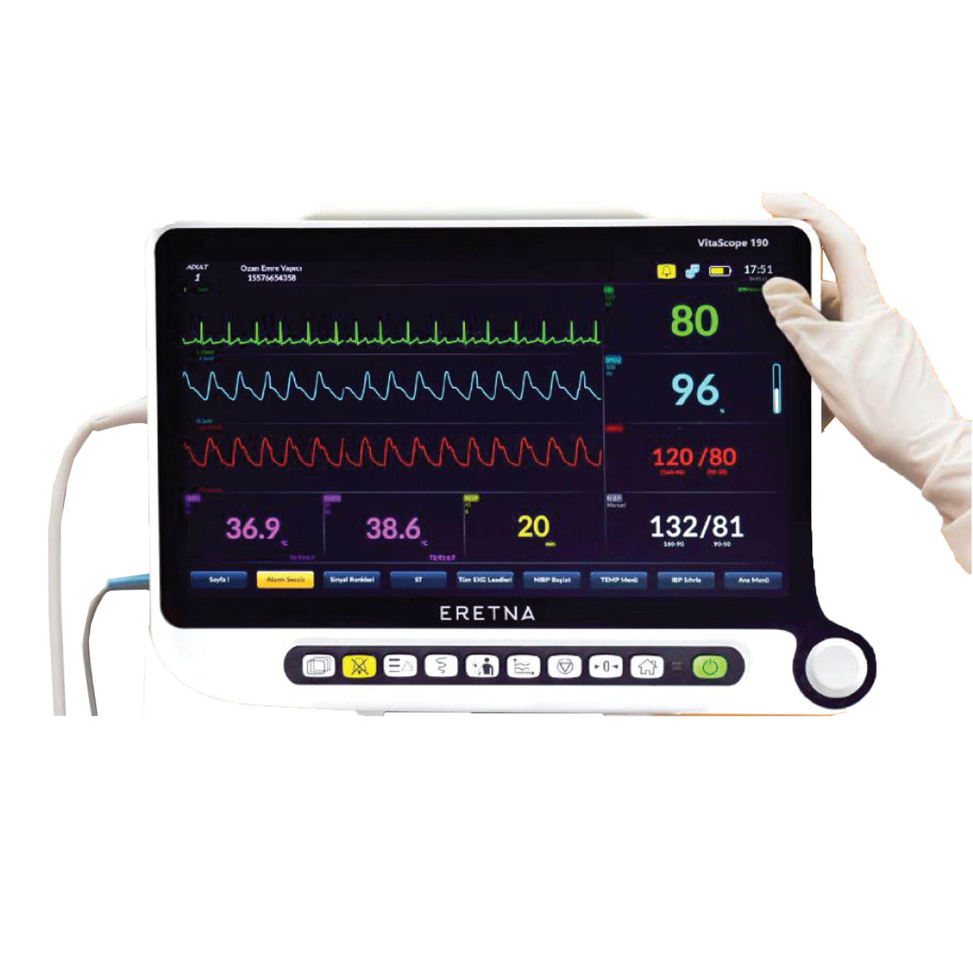 Patient Monitor – Real-Time Vital Sign Monitoring