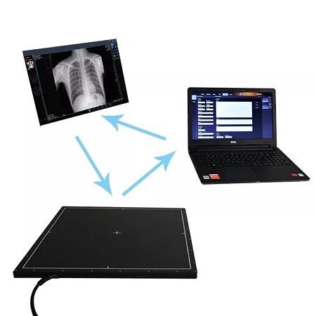 17*17 Wireless Portable Flat Panel X Ray Detector Dr-flat-panel-detector Flat Panel Detector